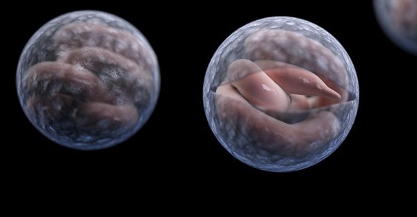 Cryptosporidium Parasite Test - Image 2